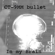 9mm bullet in brain